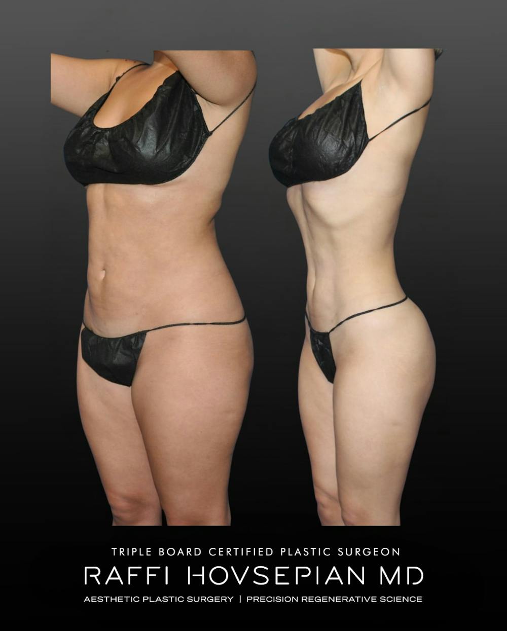 Procedures Before & After Gallery - Patient 189319 - Image 3