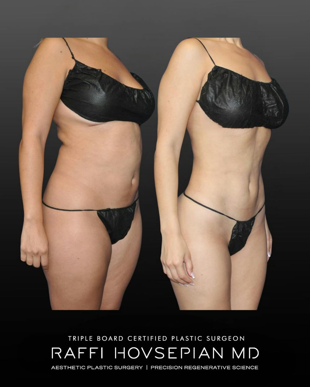Procedures Before & After Gallery - Patient 189319 - Image 2
