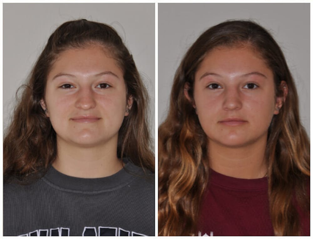 Rhinoplasty Before & After Gallery - Patient 30624174 - Image 1