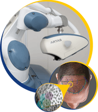 ARTAS machine with demonstration of how it places hair implant