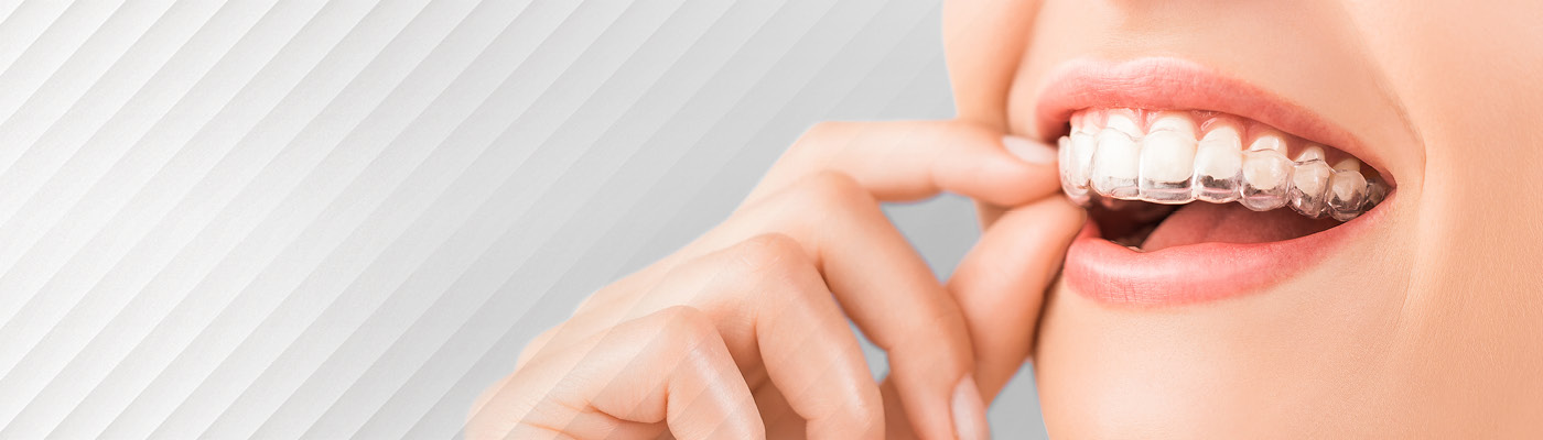 Invisalign