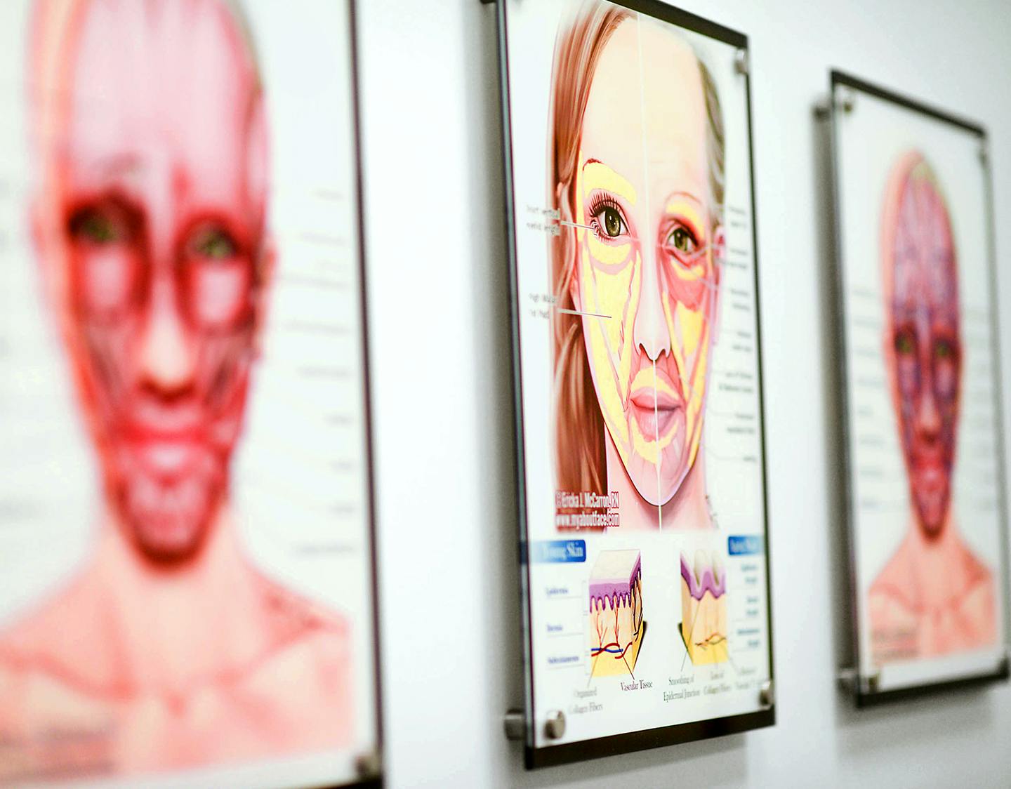 Coolpeel About Face Medical Aesthetics