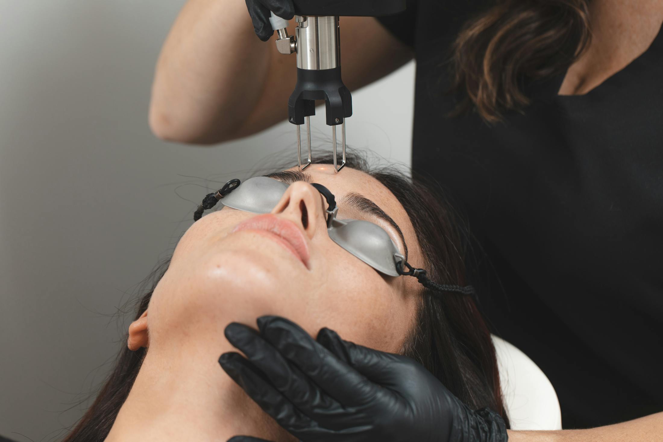 Laser Skin Resurfacing Portsmouth | Stratham Skin Resurfacing