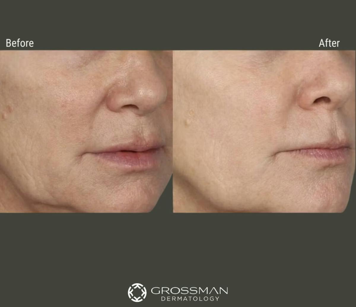 M8 Before & After Gallery - Patient 199099 - Image 2