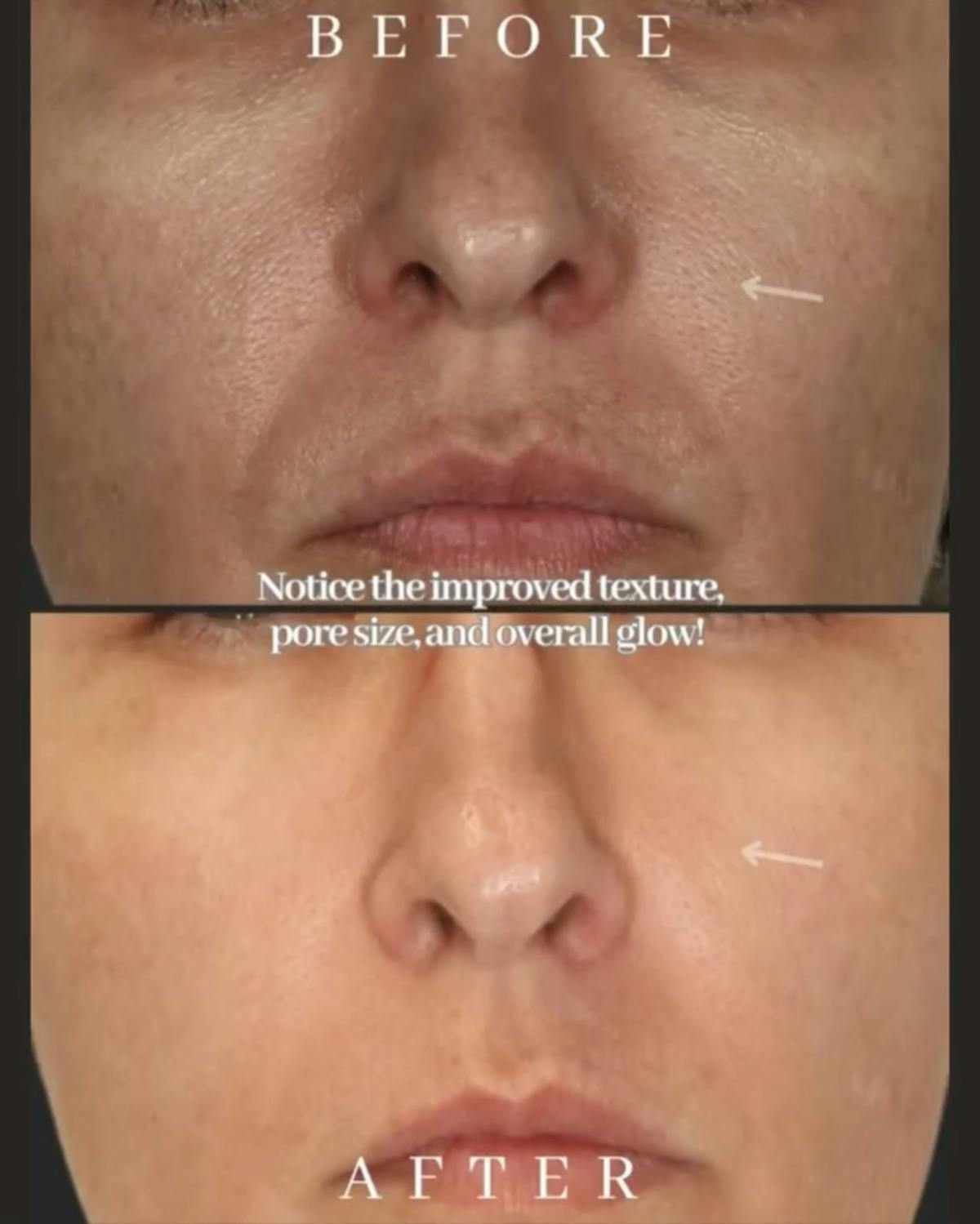 Skinvive Before & After Gallery - Patient 125157 - Image 1