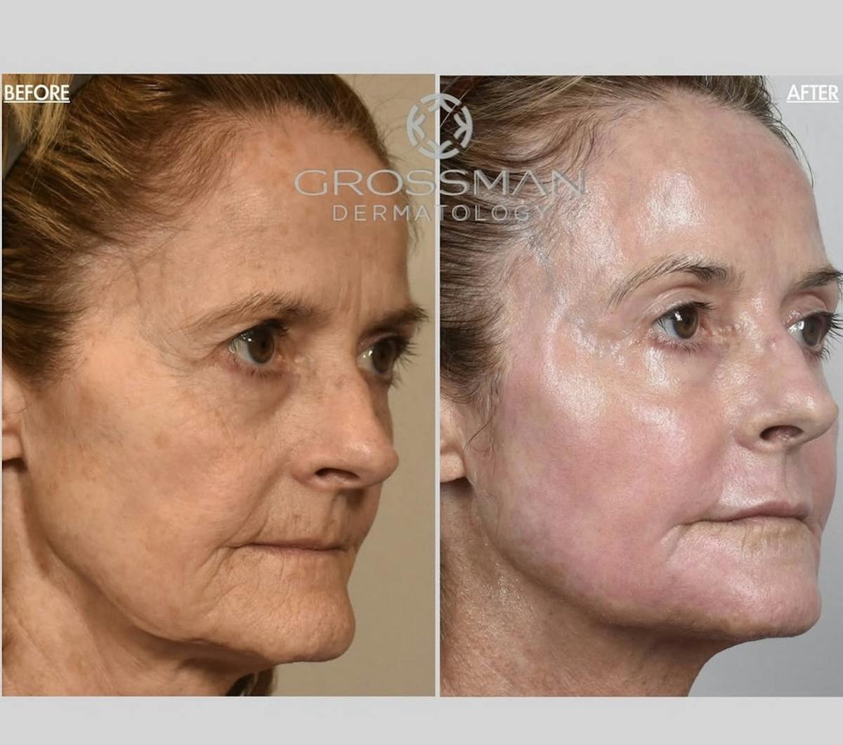 KustomeKarynKombo Before & After Gallery - Patient 965783 - Image 1