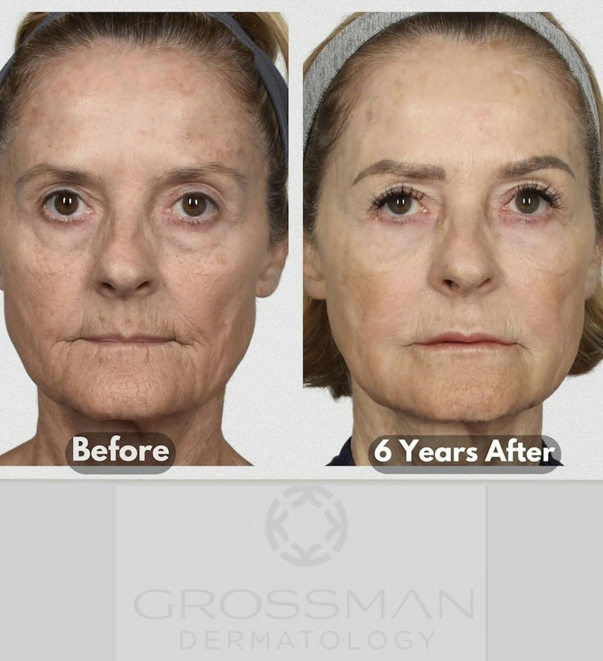 KustomeKarynKombo Before & After Gallery - Patient 186540 - Image 1