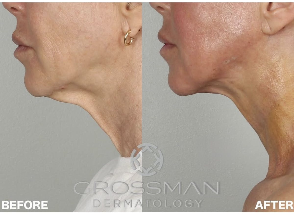 KustomeKarynKombo Before & After Gallery - Patient 276018 - Image 1