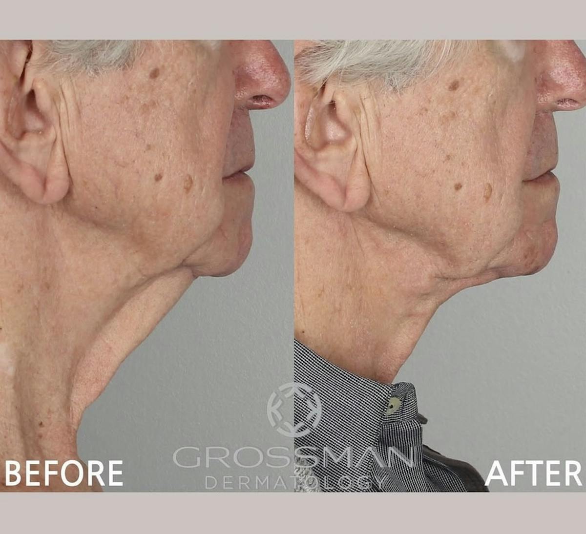 KustomeKarynKombo Before & After Gallery - Patient 682821 - Image 1