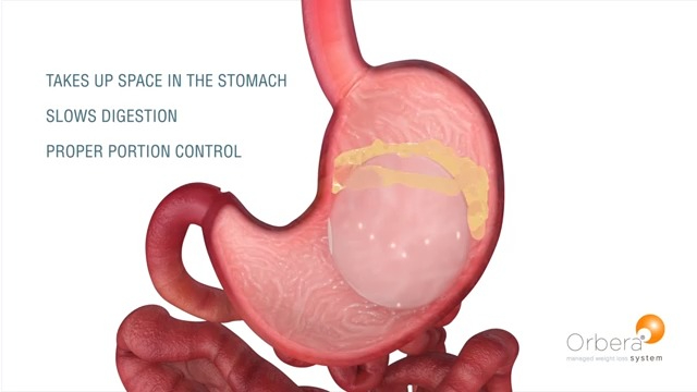 diagram of a human stomach