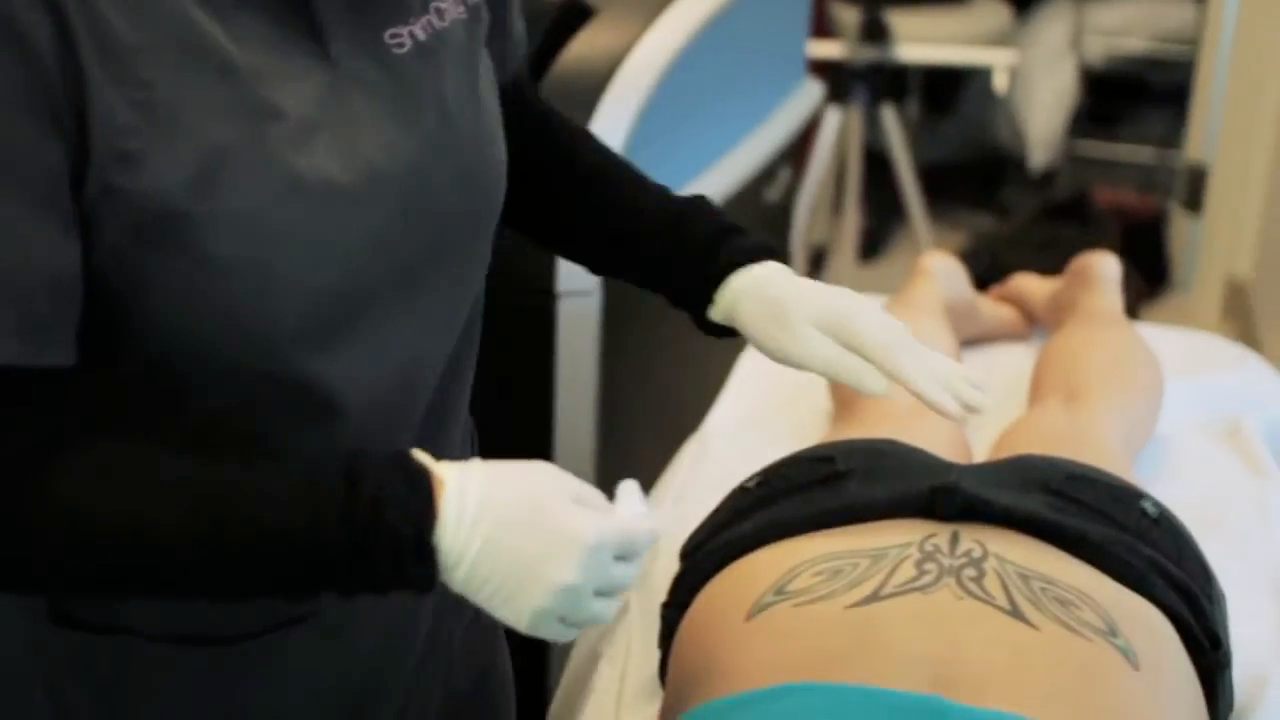 a patient laying on their stomach with a tattoo showing on their back
