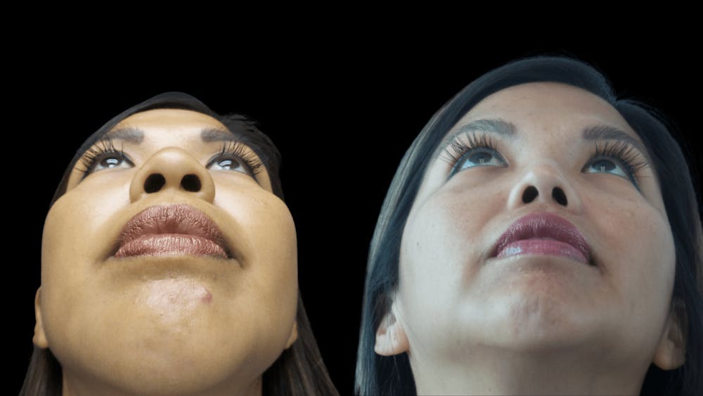 Rhinoplasty Before & After Gallery - Patient 38290653 - Image 3