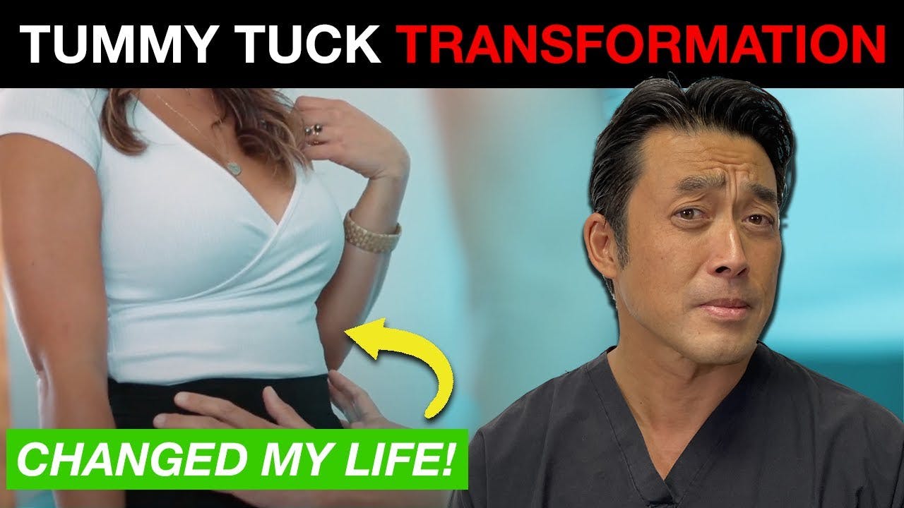 Tummy Tuck Video