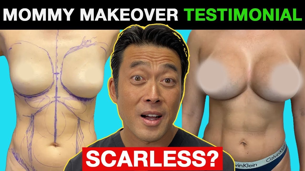 Mommy Makeover Video