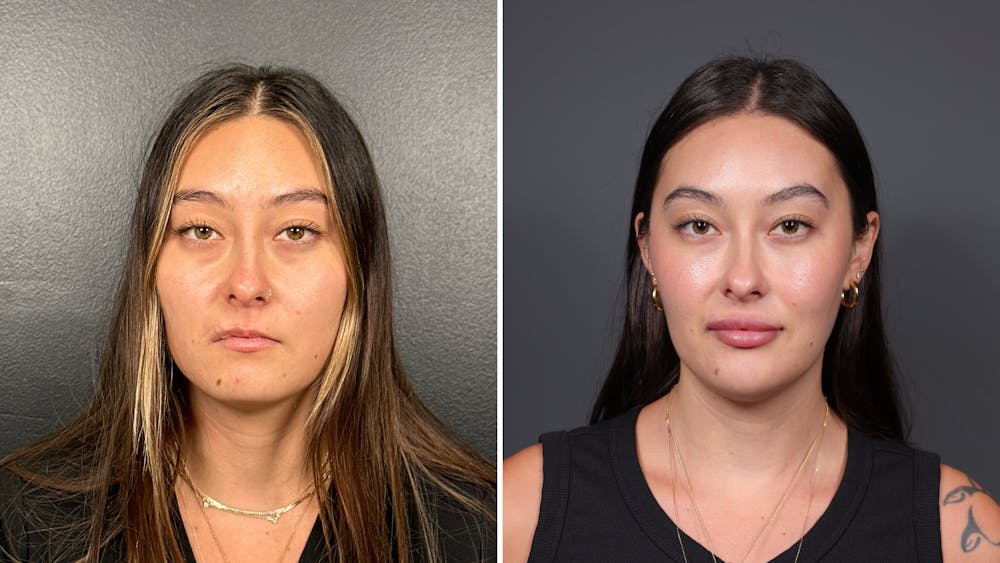 Dermal Fillers Before & After Gallery - Patient 155867 - Image 1