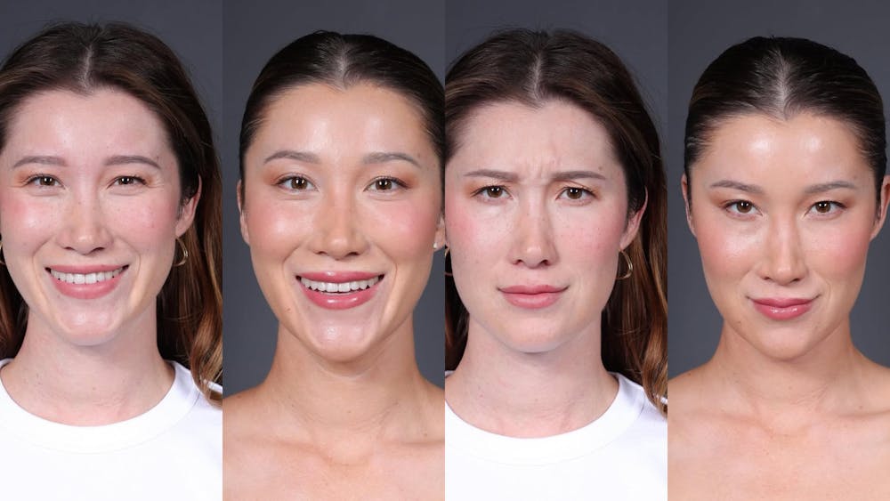 BOTOX/Daxxify Before & After Gallery - Patient 302099 - Image 1