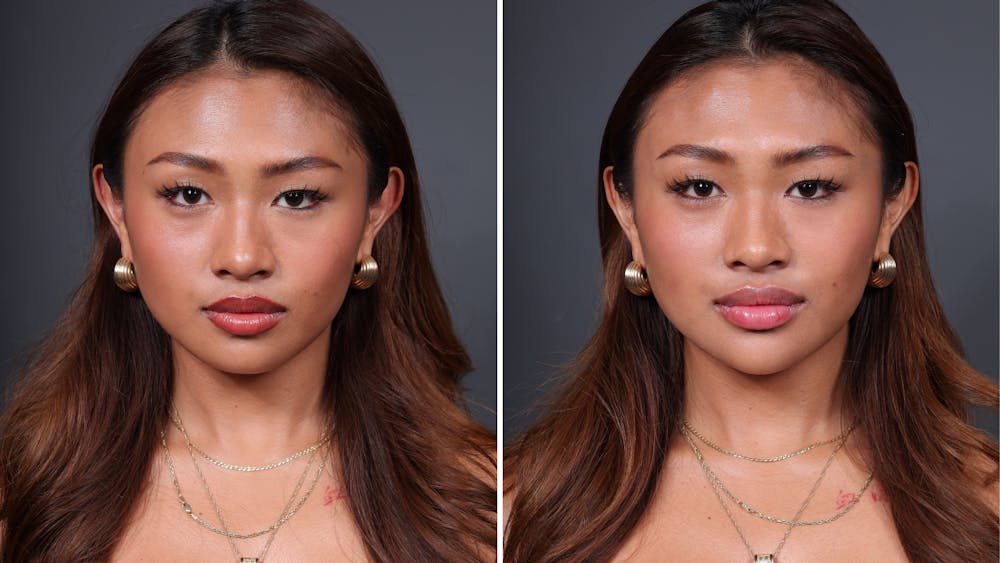 BOTOX/Daxxify Before & After Gallery - Patient 429606 - Image 1
