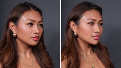 BOTOX/Daxxify Before & After Gallery - Patient 429606 - Image 2