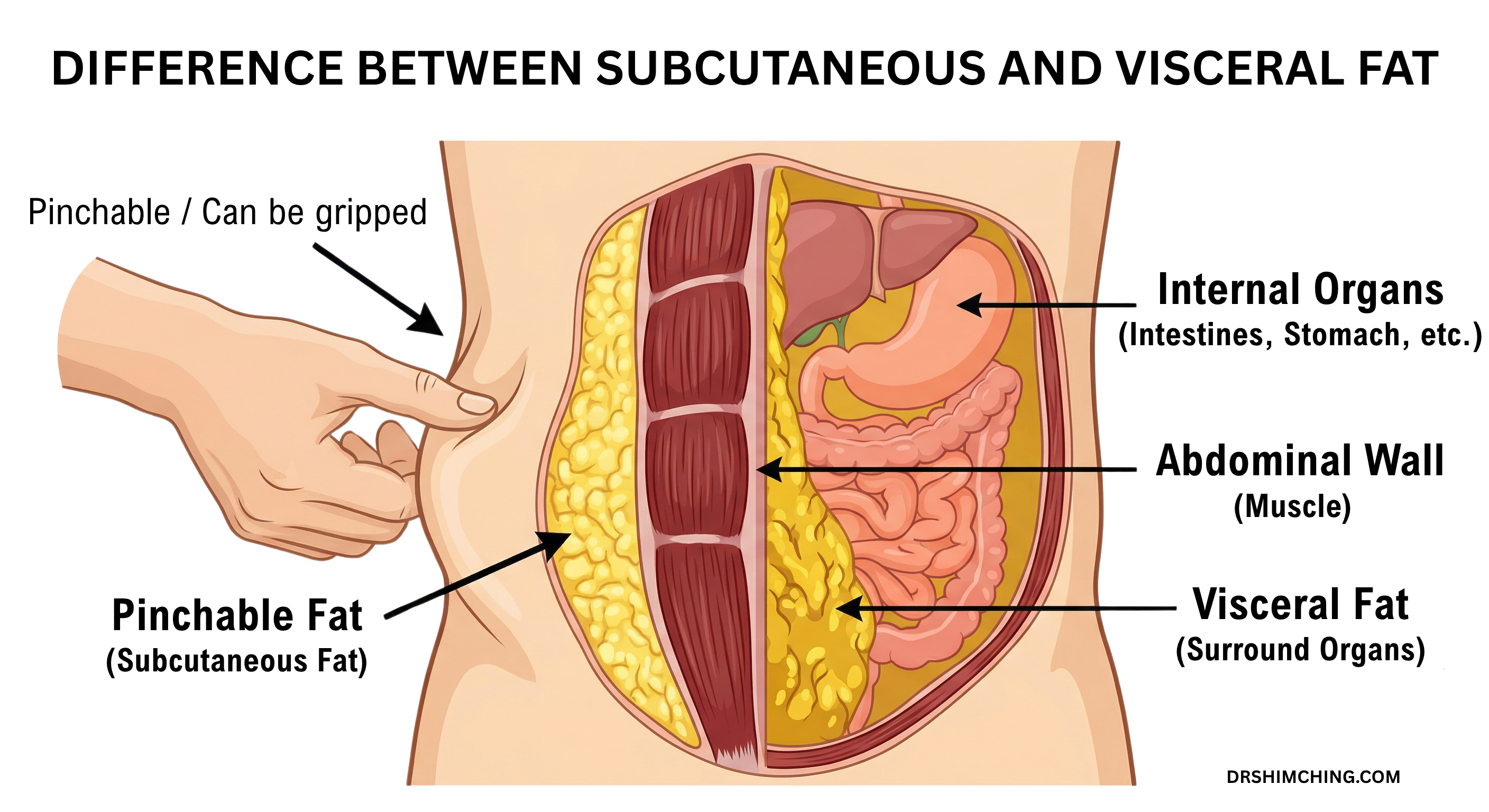 The visual difference between subcutaneous fat (pinchable) and visceral fat (deep, around organs).
