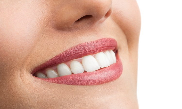 Samadian Cosmetic & Advanced Dentistry Blog | What is a full smile makeover?