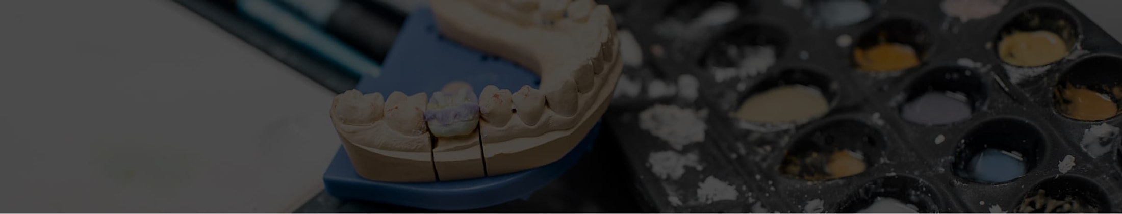 Model of teeth