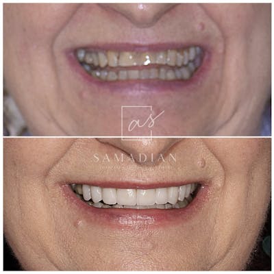 cosmetic dentistry results