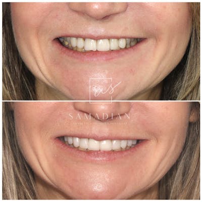 cosmetic dentistry results