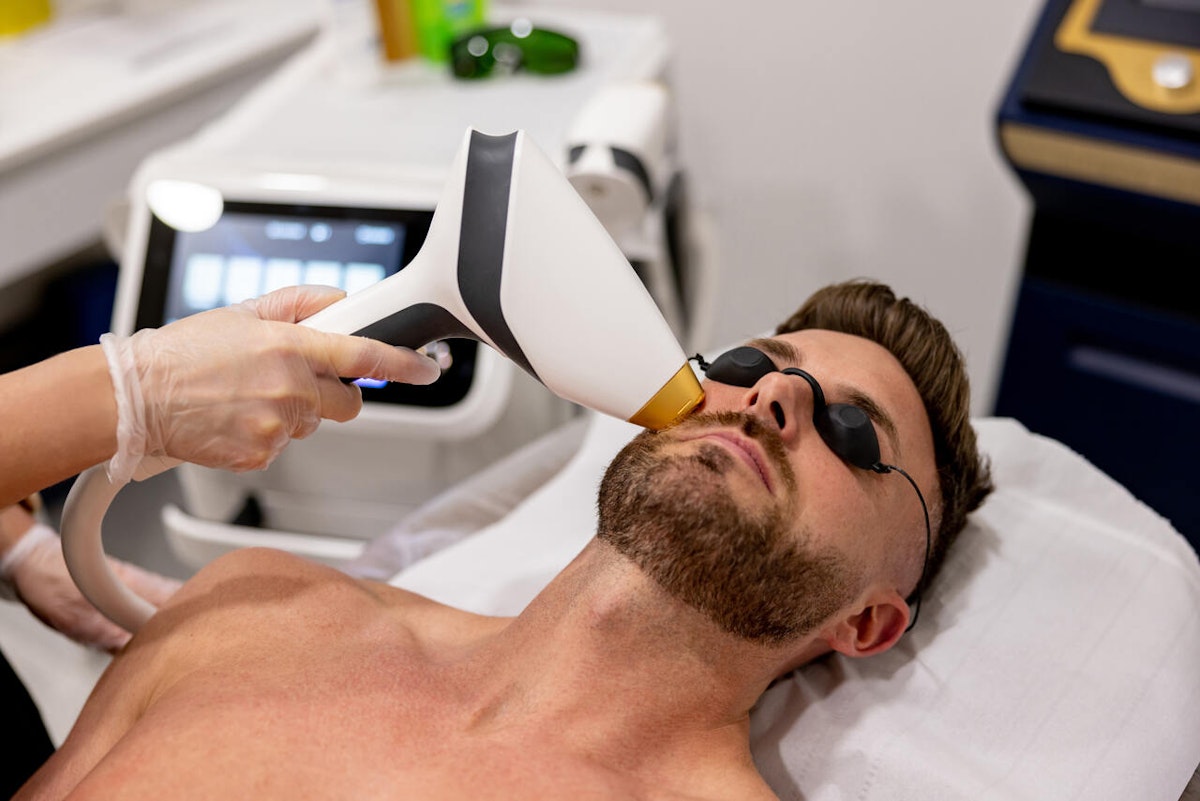 Depilação a laser masculina é a tendência do momento! Saiba mais