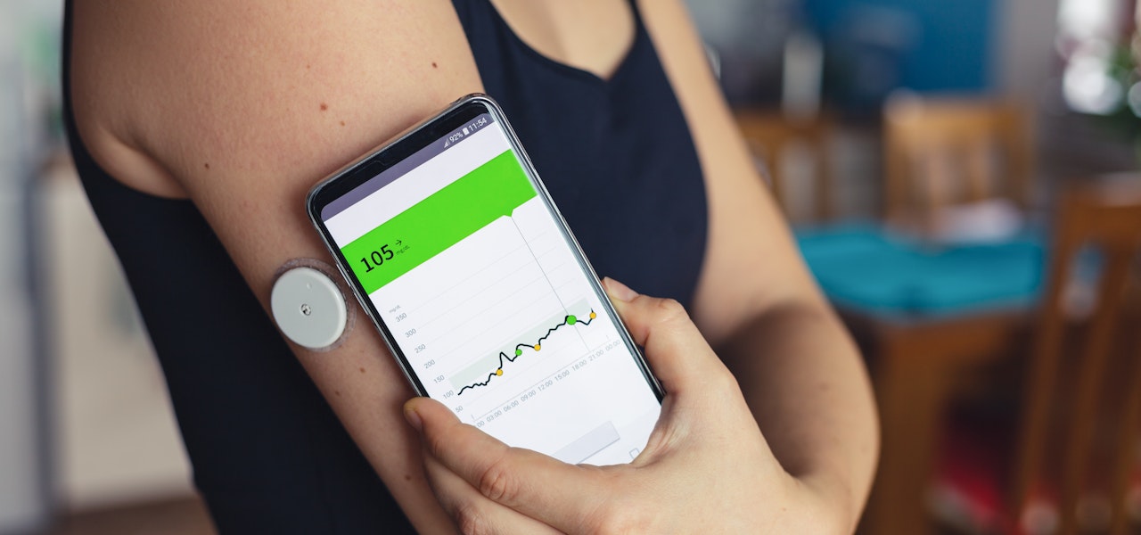 woman-with-continuous-glucose-monitor