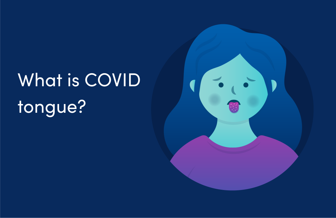 What is ‘COVID tongue’ and what does it look like?