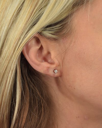 Earlobe Repair Before & After Gallery - Patient 36543094 - Image 2