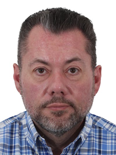 Blepharoplasty Before & After Gallery - Patient 393354 - Image 1