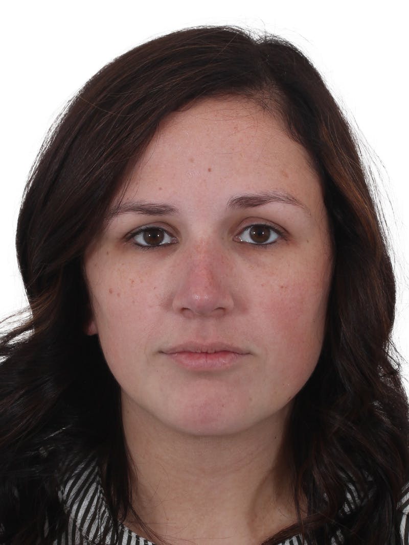 Chin Augmentation Before & After Gallery - Patient 165640 - Image 4