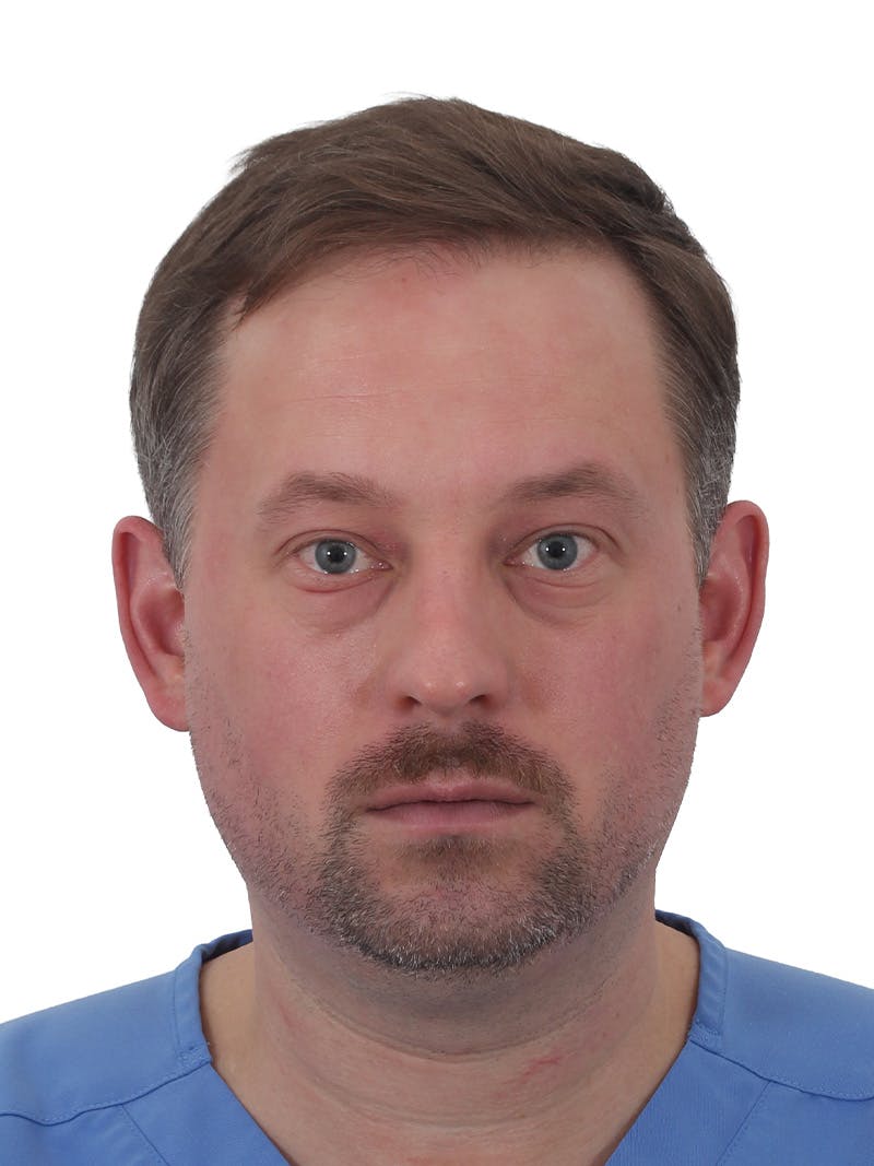Facelift/Neck Lift Before & After Gallery - Patient 366161 - Image 11