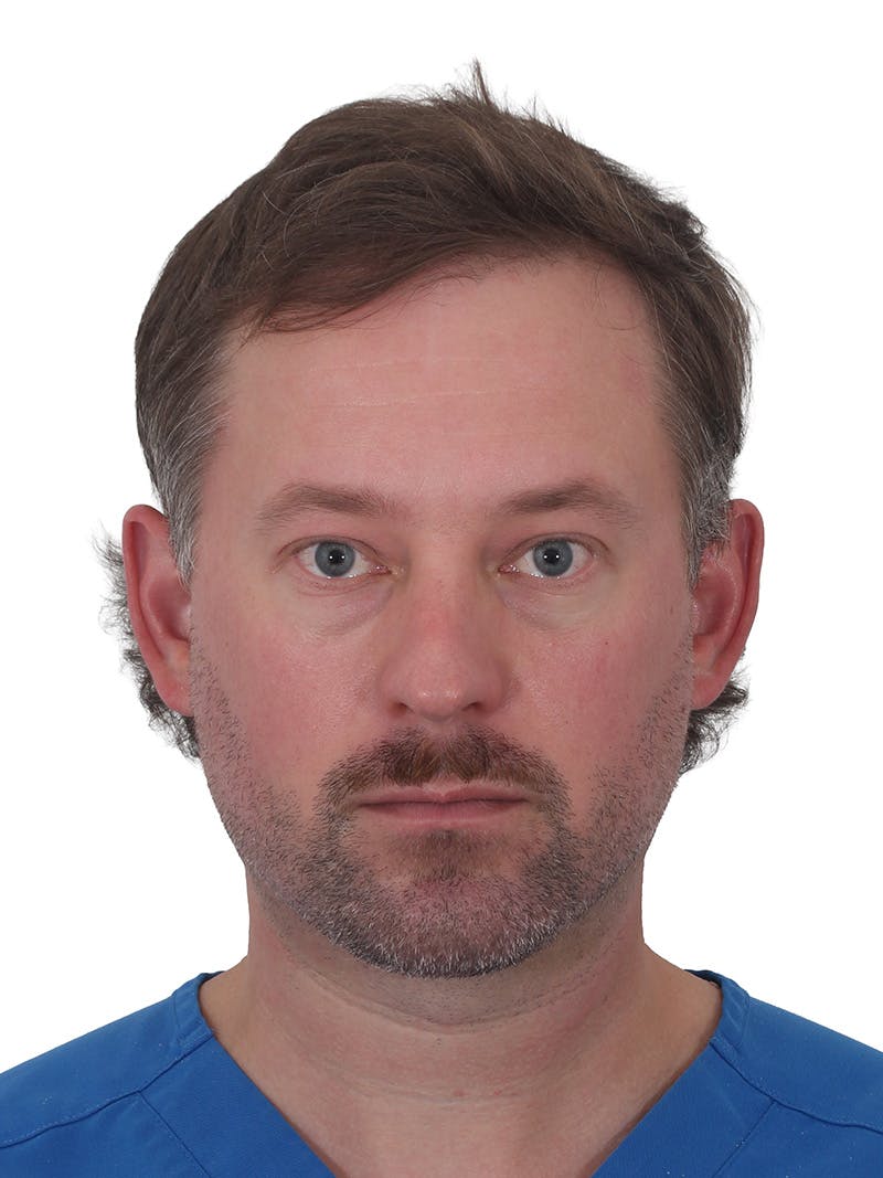 Facelift/Neck Lift Before & After Gallery - Patient 366161 - Image 12