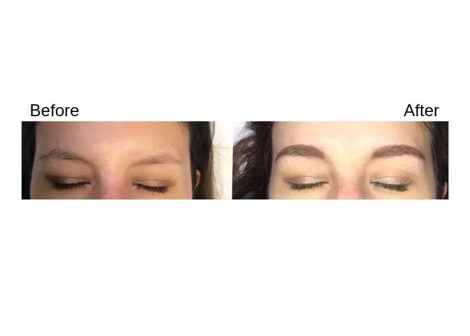 Microblading Before & After Gallery - Patient 123746034 - Image 1