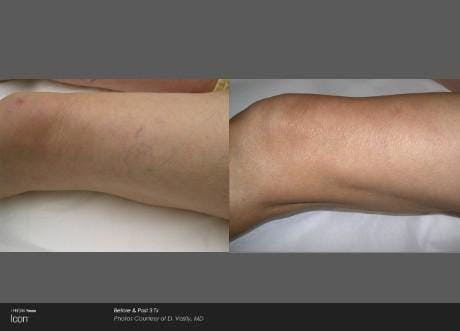 Skin Rejuvenation Before & After Gallery - Patient 41897302 - Image 1