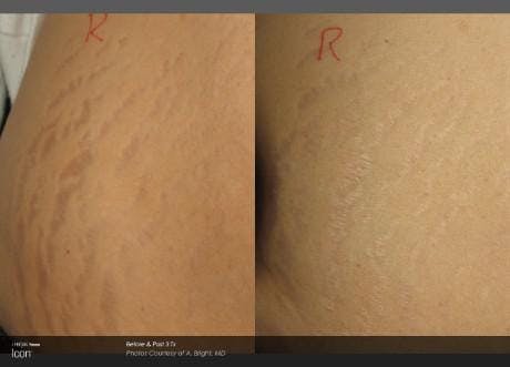 Skin Rejuvenation Gallery - Patient 41897321 - Image 1