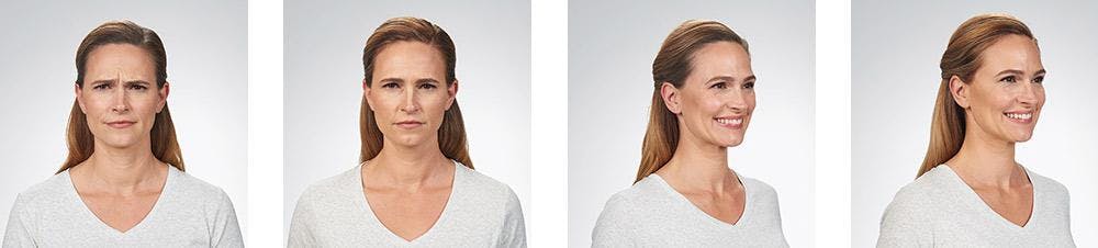 Botox/Xeomin Before & After Gallery - Patient 41897362 - Image 1
