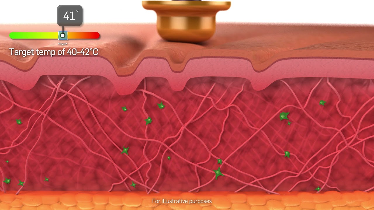 Tempsure Envi diagram