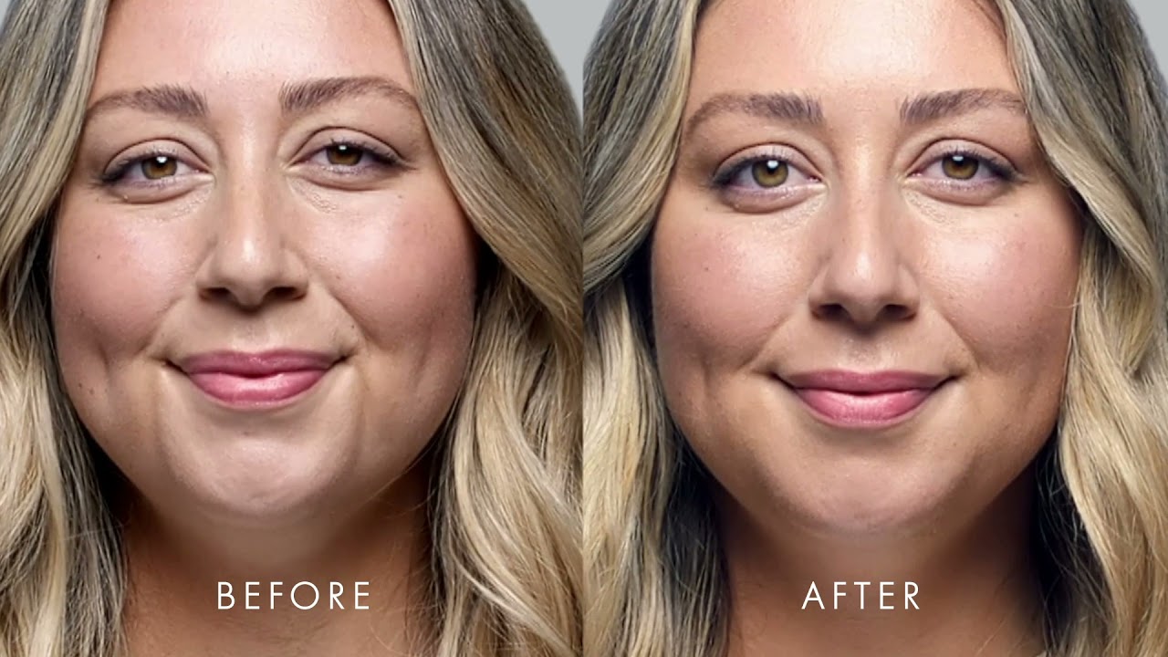 Before and after photos
