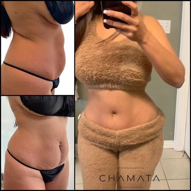 Reels Gallery - Archive of instagram images etc Before & After Gallery - Patient 104029341 - Image 1