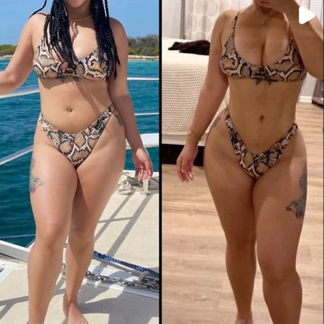 BBL and ab etching before and after