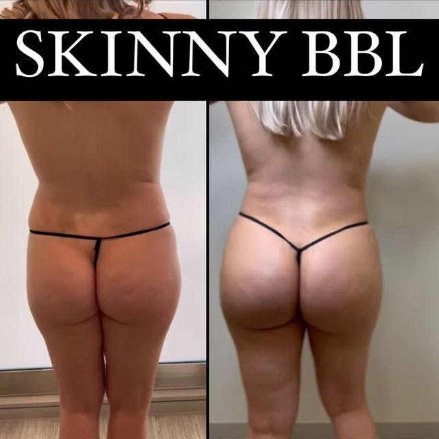 Reels Gallery - Archive of instagram images etc Before & After Gallery - Patient 140399528 - Image 1