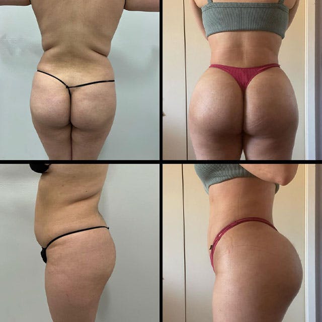 Reels Gallery - Archive of instagram images etc Before & After Gallery - Patient 140399573 - Image 1