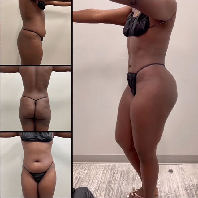 Reels Gallery - Archive of instagram images etc Before & After Gallery - Patient 142440437 - Image 1