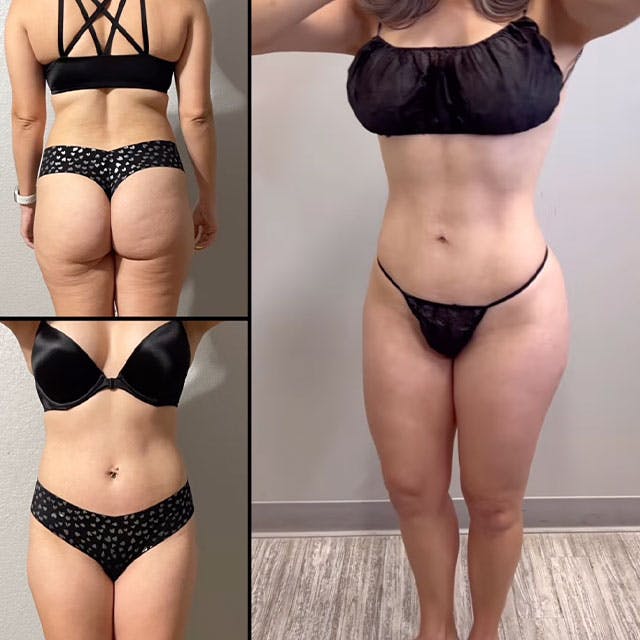 Reels Gallery - Archive of instagram images etc Before & After Gallery - Patient 142440442 - Image 1