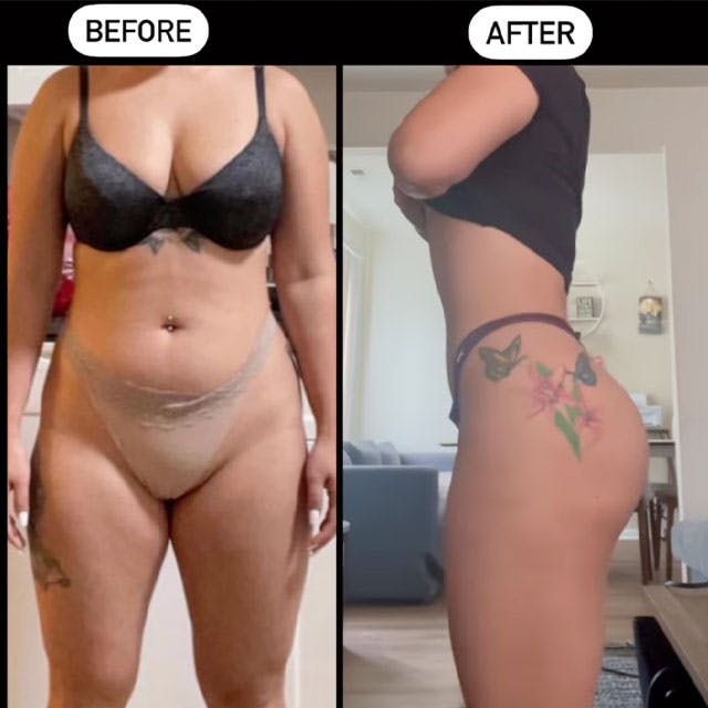 Reels Gallery - Archive of instagram images etc Before & After Gallery - Patient 143442397 - Image 1