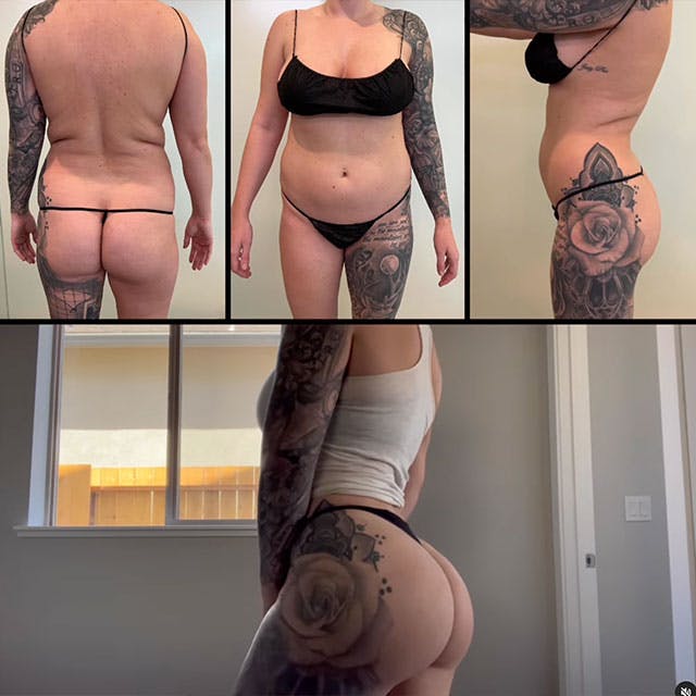 BBL before and after