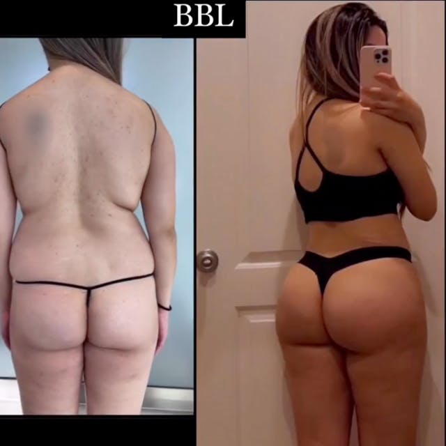 Reels Gallery - Archive of instagram images etc Before & After Gallery - Patient 140598 - Image 1